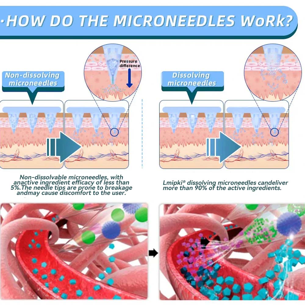 【Last Day Promotion 60% OFF🥇】 Lmipki® NIDDK-Tirzepatide Nano Microneedle Patch🧀(Zero Pain, 24/7 Release | Lose 20lbs FAST | 90% Sugar Drop | )