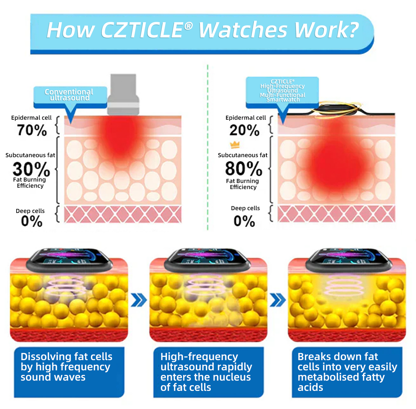 CZTICLE® High-Frequency Ultrasound Multi-Functional Smartwatch(Specifically Designed for Fat Burning, Blood Sugar Balance, Lymphatic Detox, Edema Reduction, and Nerve Relaxation)