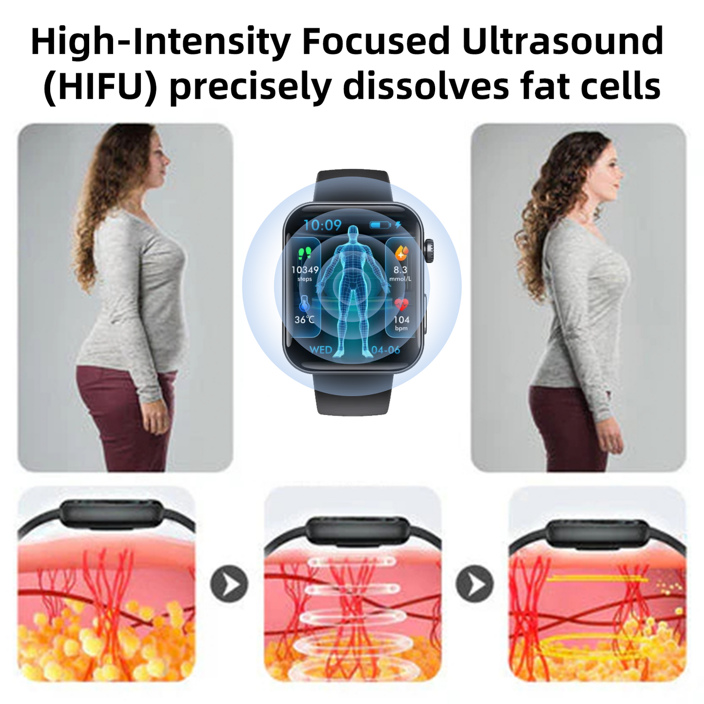 CZTICLE® High-Frequency Ultrasound Multi-Functional Smartwatch(Specifically Designed for Fat Burning, Blood Sugar Balance, Lymphatic Detox, Edema Reduction, and Nerve Relaxation)