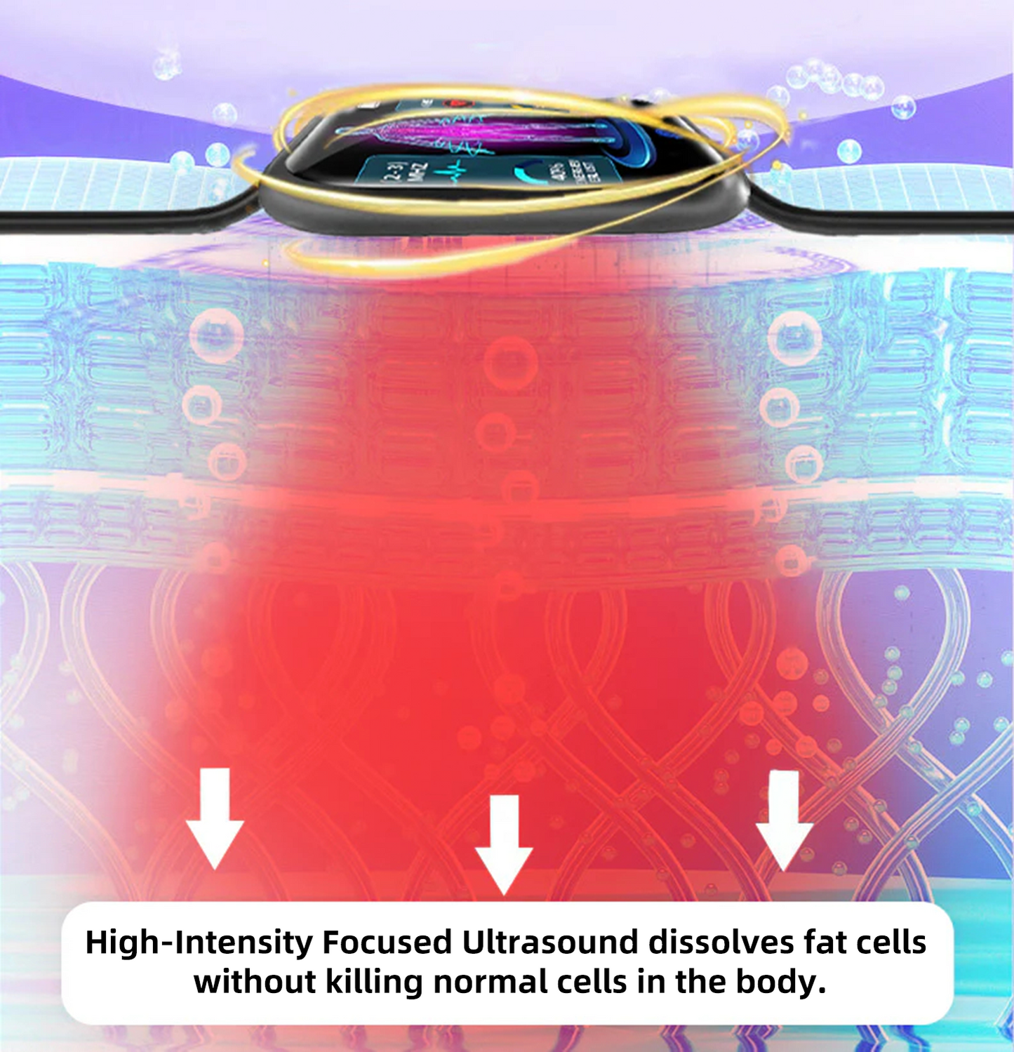 CZTICLE® High-Frequency Ultrasound Multi-Functional Smartwatch(Specifically Designed for Fat Burning, Blood Sugar Balance, Lymphatic Detox, Edema Reduction, and Nerve Relaxation)