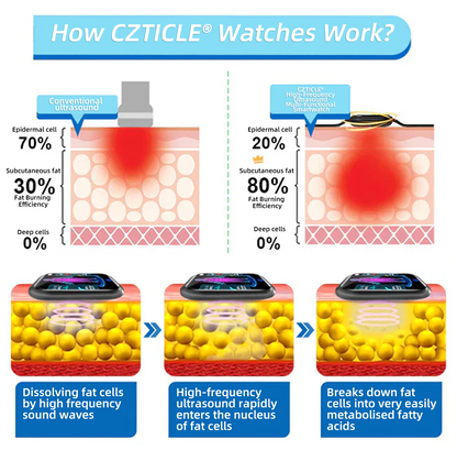 CZTICLE® High-Frequency Ultrasound Multi-Functional Smartwatch(Specifically Designed for Fat Burning, Blood Sugar Balance, Lymphatic Detox, Edema Reduction, and Nerve Relaxation)